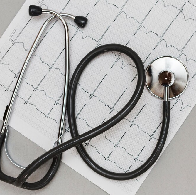 ECG